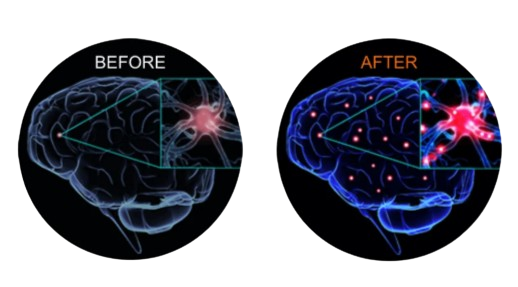 MemoShield before and after